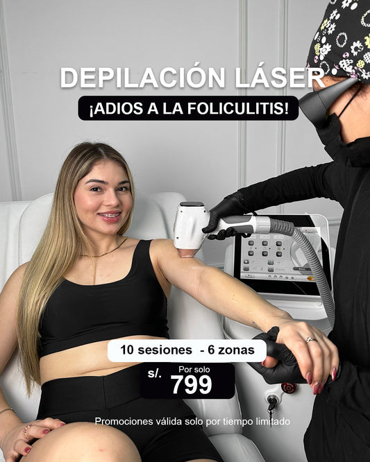 Depilación laser